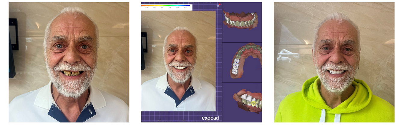 Digitale Smile-Design: Sehen Sie Ihr neues Lächeln schon vor der Behandlung