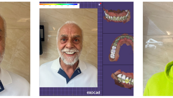 Digitale Smile-Design: Sehen Sie Ihr neues Lächeln schon vor der Behandlung