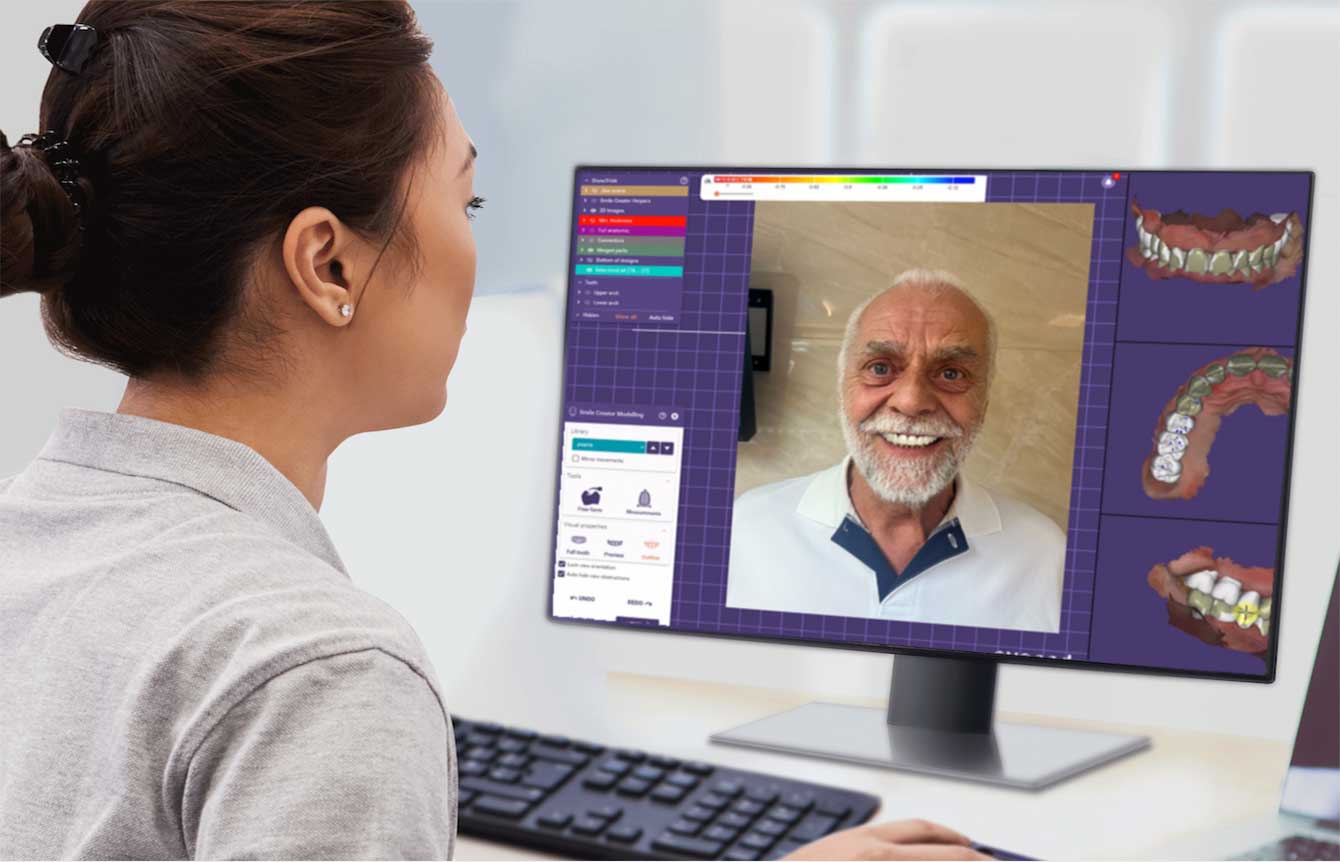 Digitale Smile-Design: Sehen Sie Ihr neues Lächeln schon vor der Behandlung