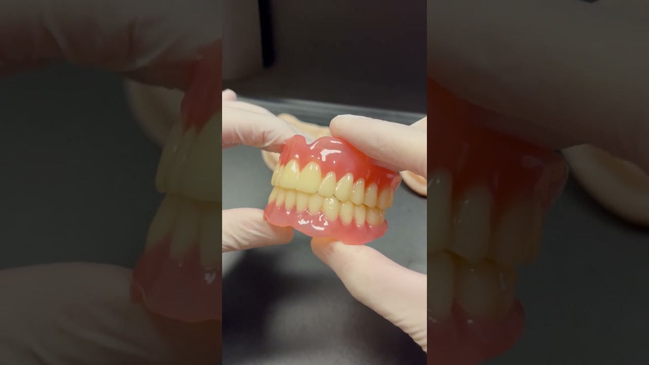 3D printed prosthesis #shorts