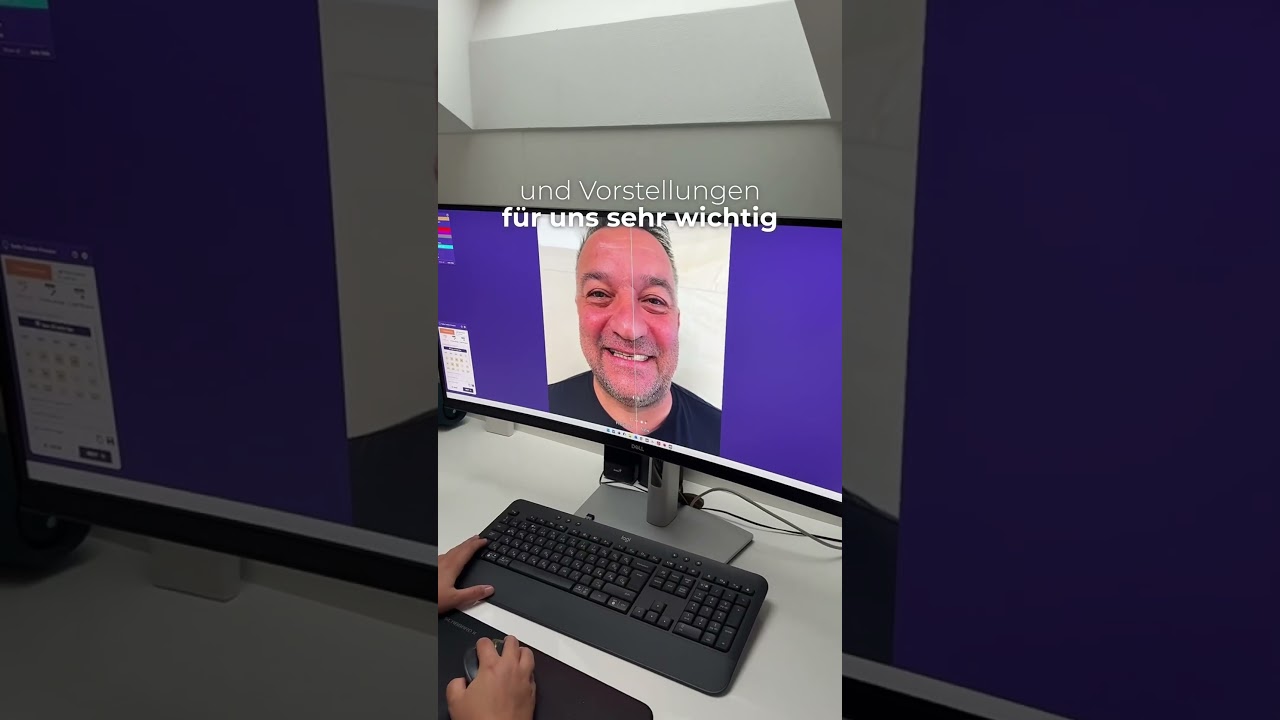 Smile Design – Denis-Focus Dental