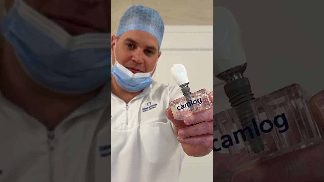 Fogászati implantátum Magyarországon digitális technológiával