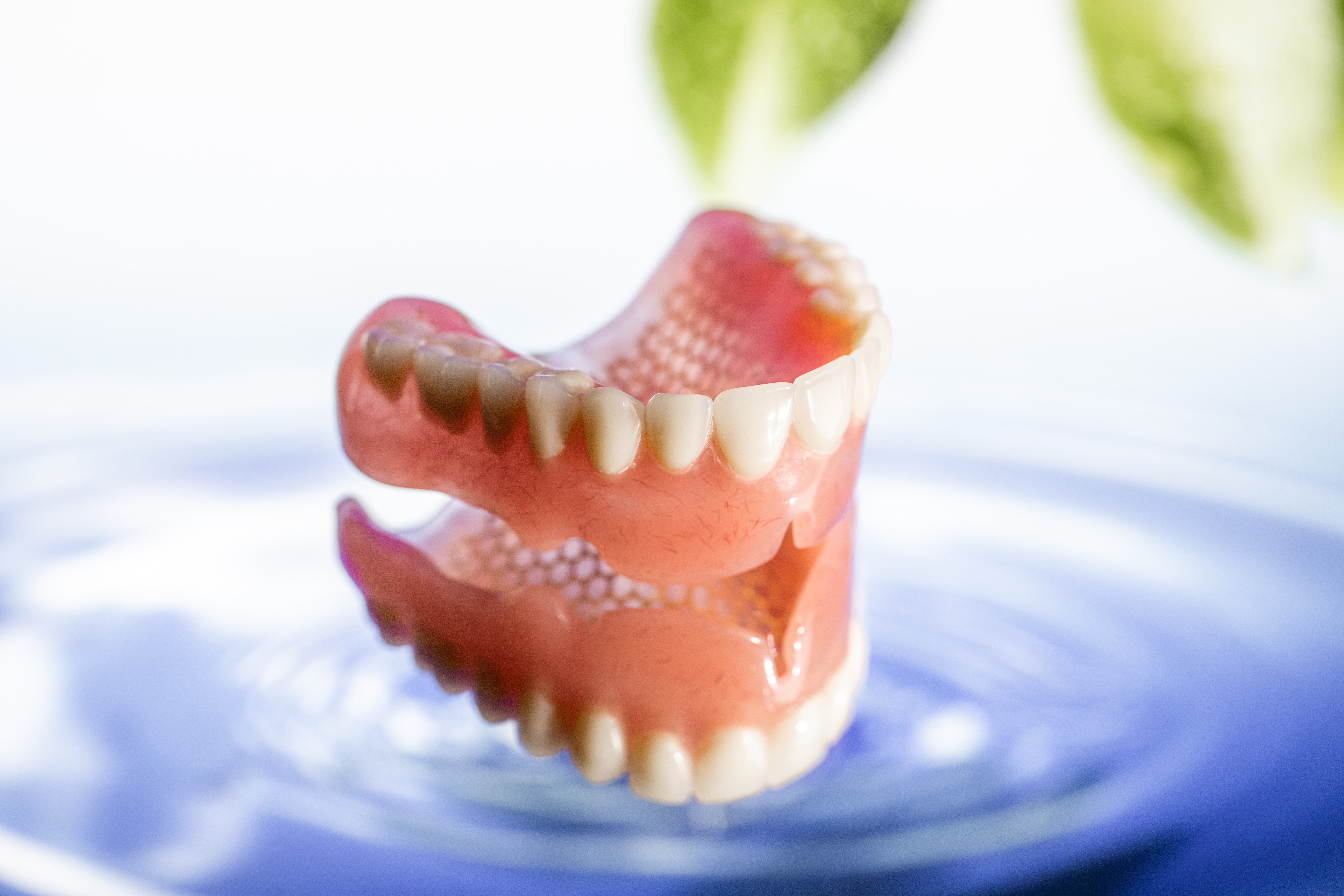 Vollprothese Beispiel