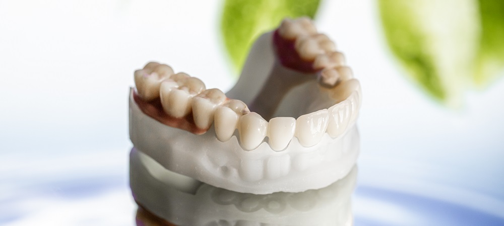 Digitale Fertigung Bio HPP Zahnersatz
