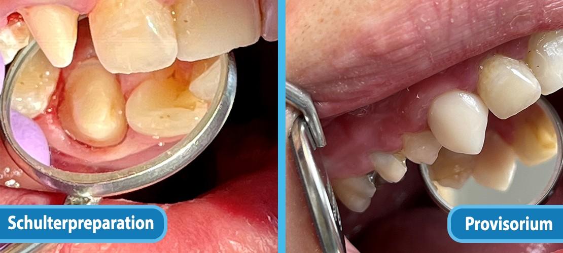 Provisional – clinical photo